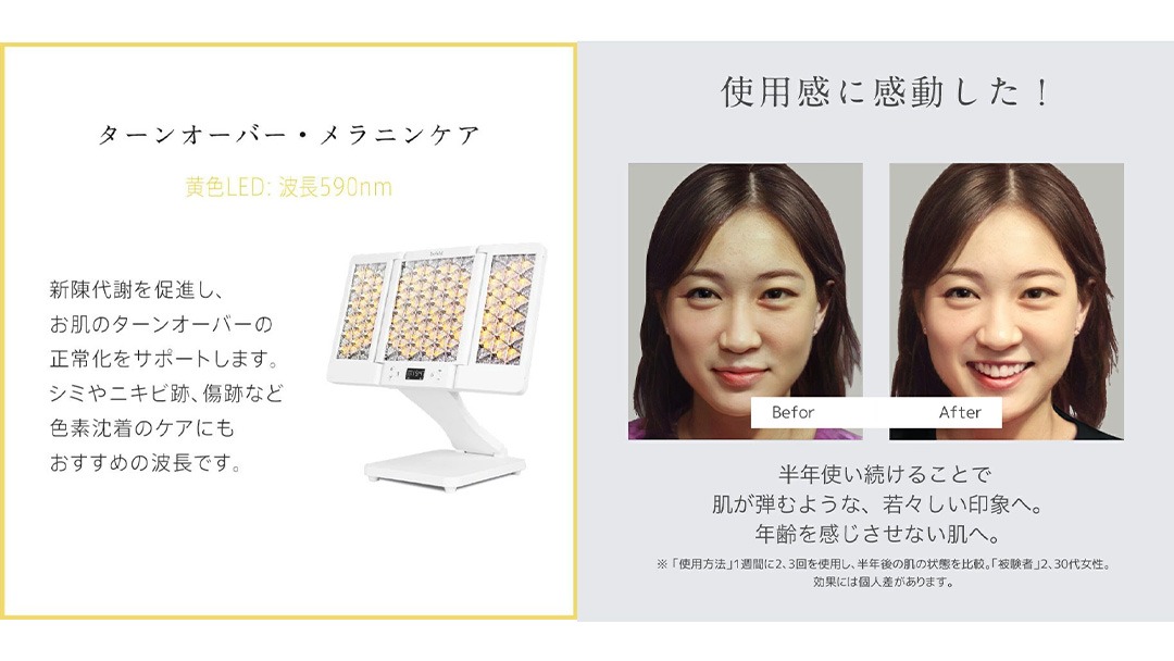 美ルル ヒカリシャイン フォトフェイシャル 美顔器 プレゼント 光 美容